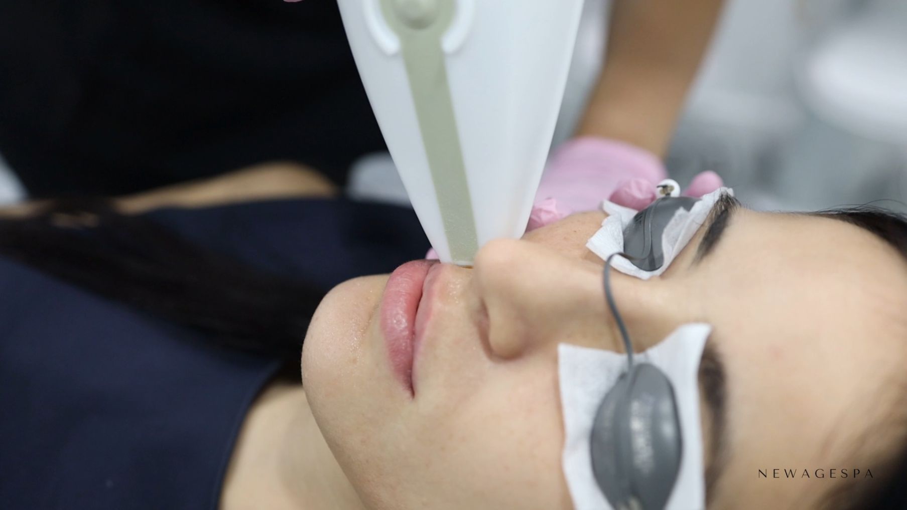 traitement facial au laser sur le visage new age spa montreal