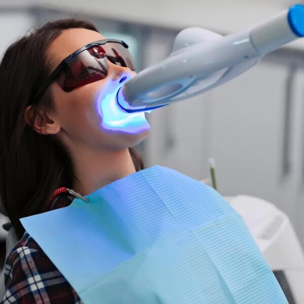Teeth whitening treatment - For 2 people